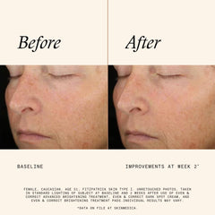 SkinMedica pad held in hand demonstrating easy application and controlled use