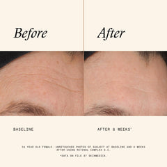 SkinMedica ingredient label close-up showing active ingredients for targeted benefit