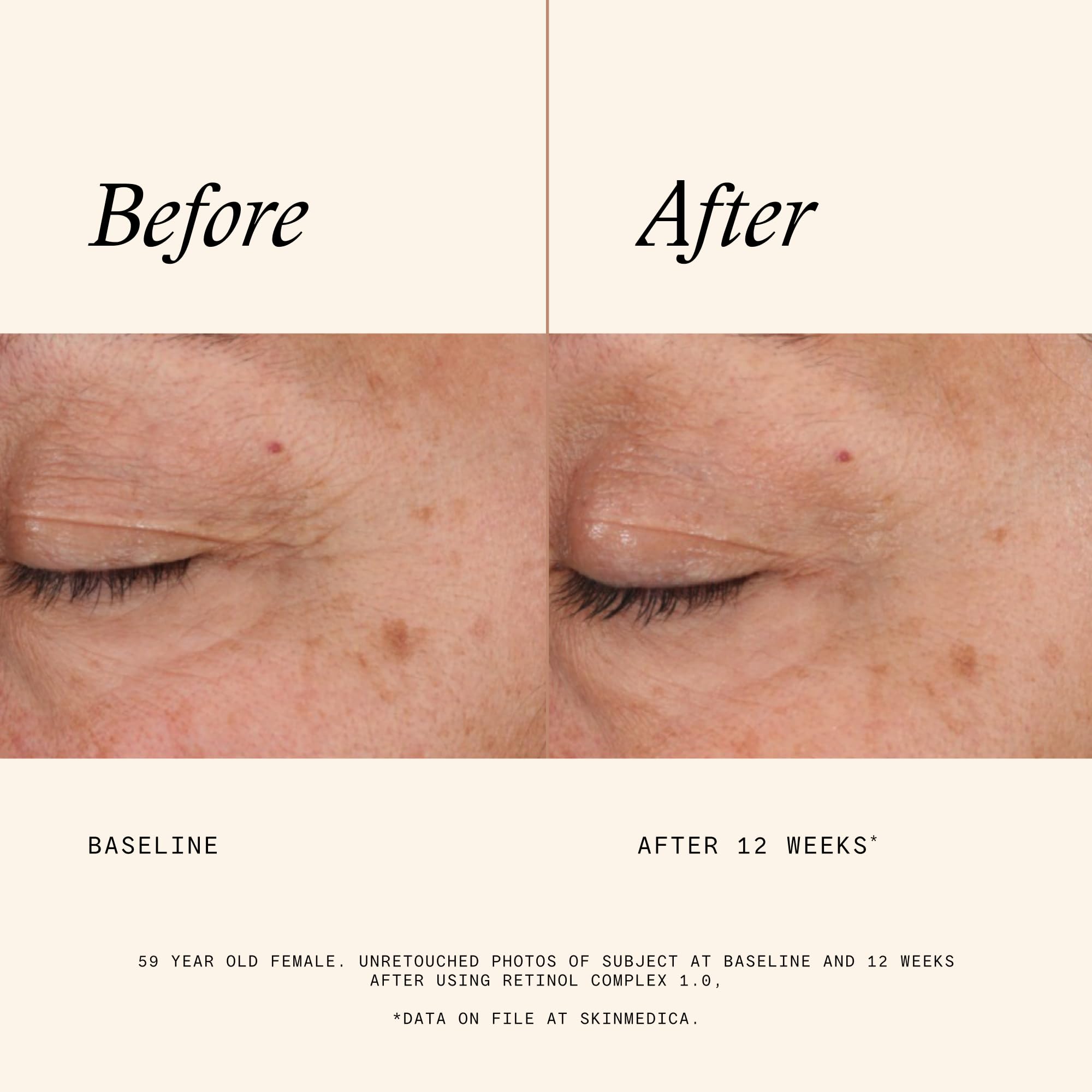 SkinMedica bottle label detail highlighting retinol strength and PhytoShield