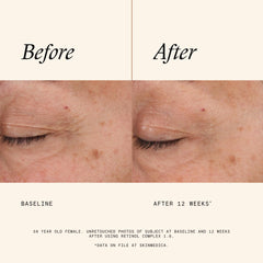 SkinMedica bottle label detail highlighting retinol strength and PhytoShield