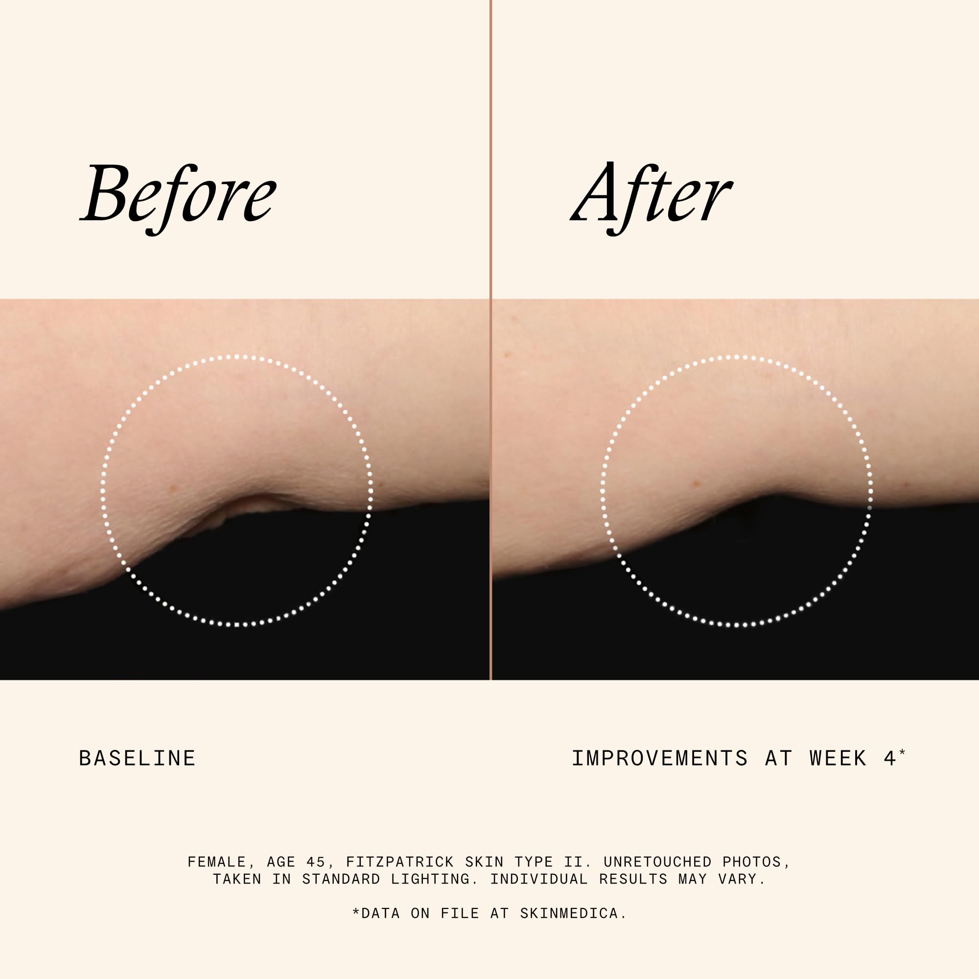 SkinMedica texture close-up showing smooth lotion consistency for quick absorption