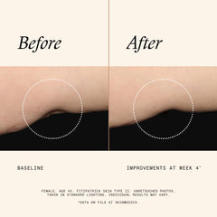 SkinMedica texture close-up showing smooth lotion consistency for quick absorption