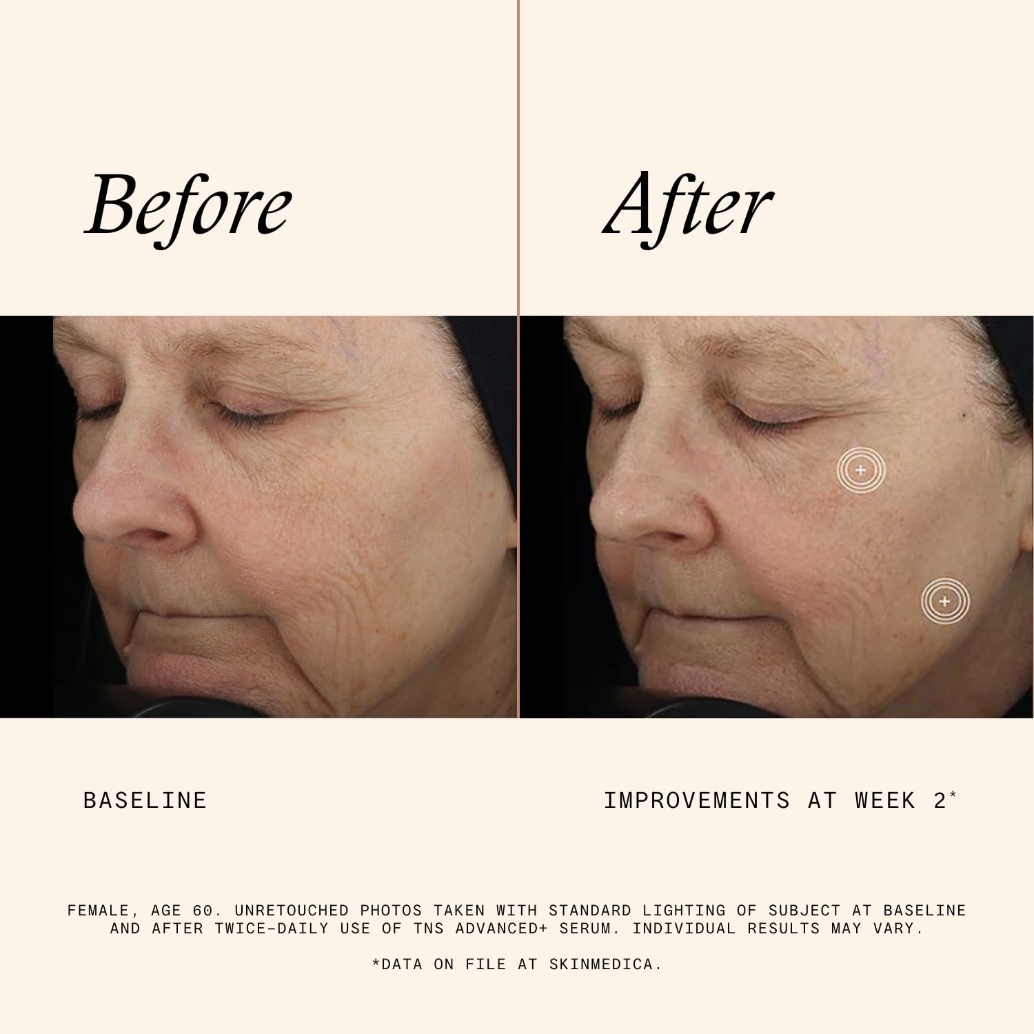 SkinMedica pump dispensing TNS Advanced plus for precise dosing and fresh mix