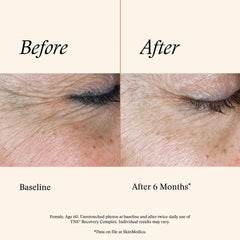 SkinMedica ingredients label close-up showing growth factor and exosome blend details