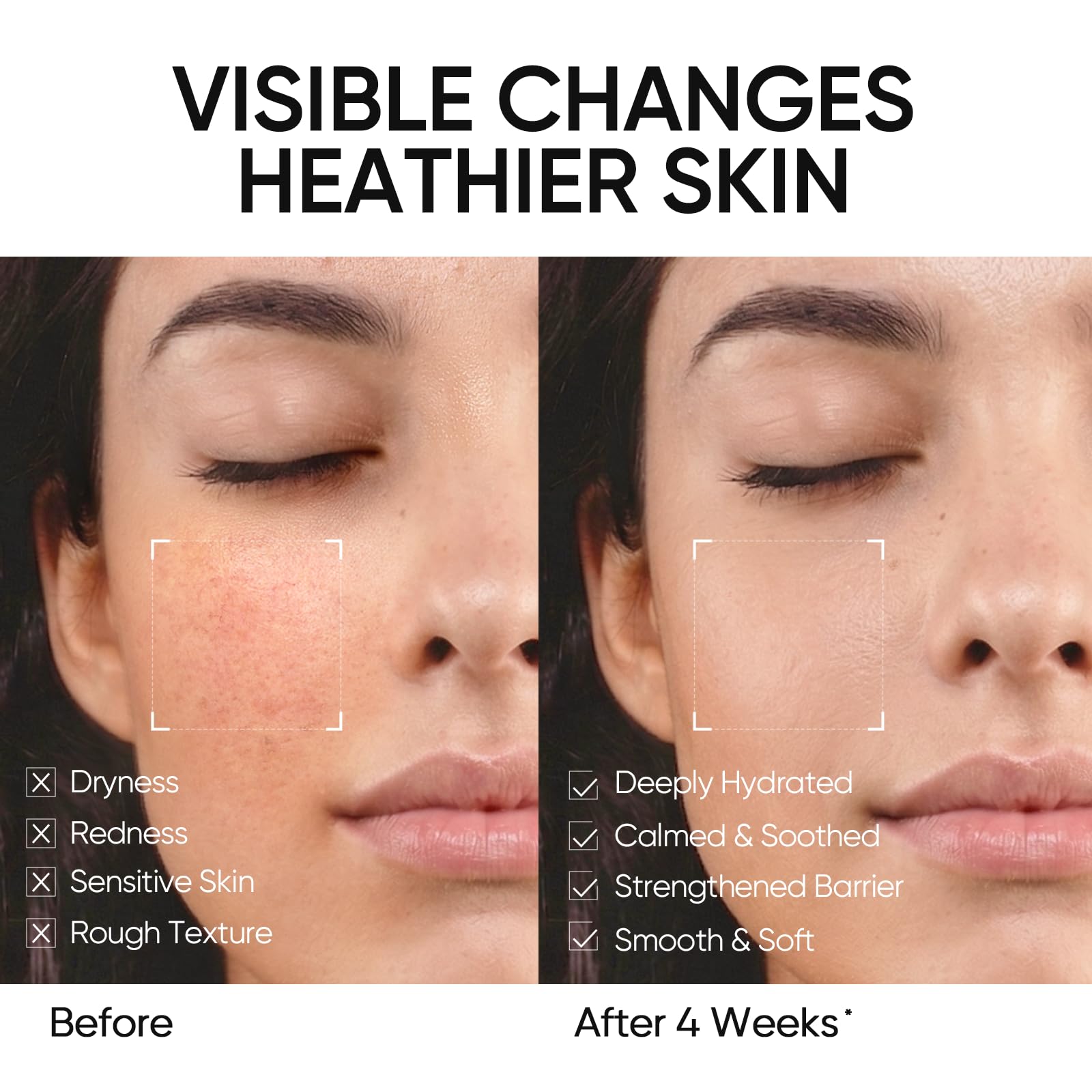 SKINTIFIC 30g size comparison in hand to show compact travel-friendly moisturizer convenience