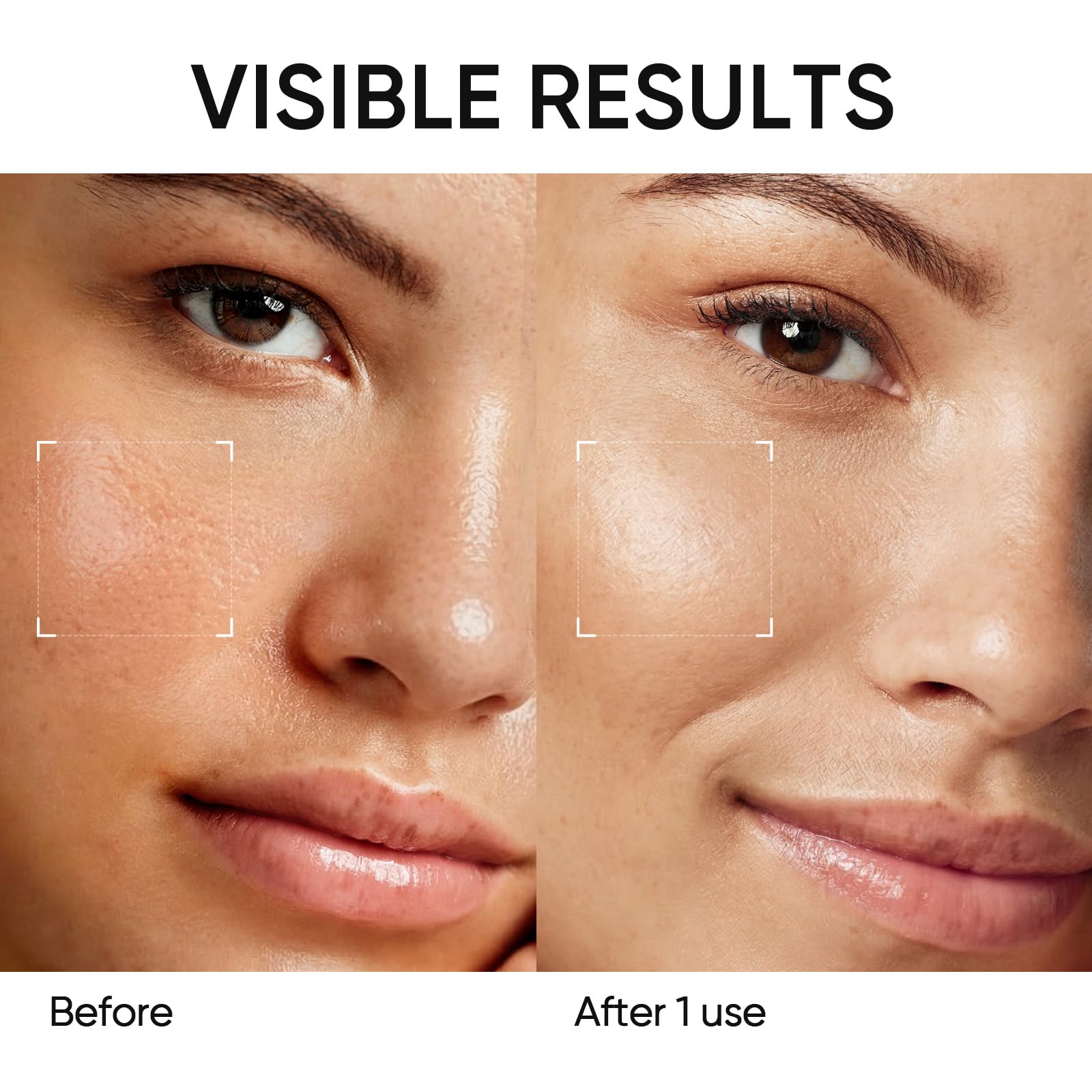 SKINTIFIC applying mask to T-zone demonstrating targeted pore cleansing