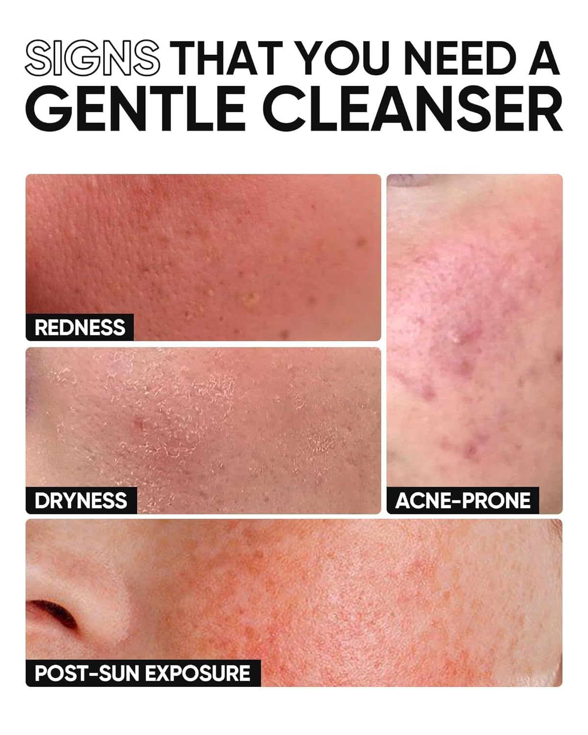 SKINTIFIC cleanser staged on bathroom shelf during morning routine, supports daily use