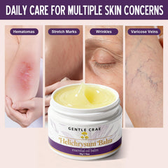 SKSOYT balm being applied to elbow to demonstrate targeted moisture and softening