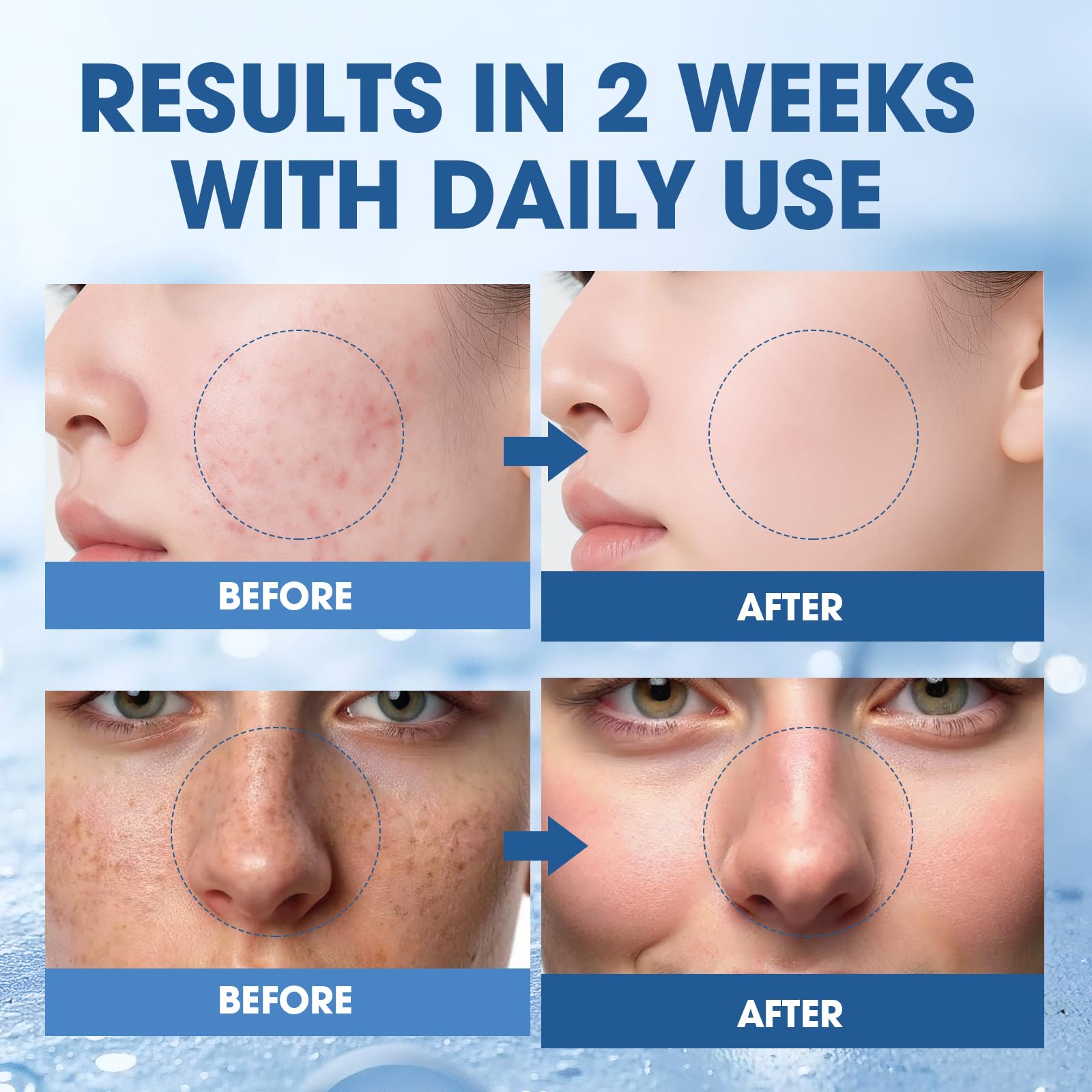 SKSOYT drop of serum on fingertip highlighting concentrated active delivery