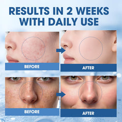 SKSOYT drop of serum on fingertip highlighting concentrated active delivery