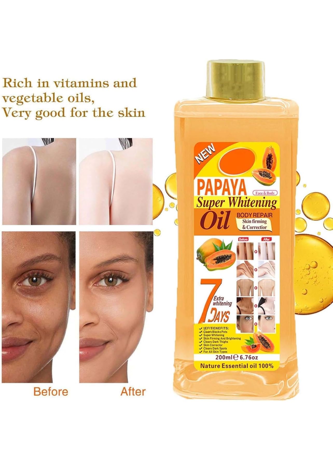 Generic Soft 7 papaya oil massaged into knee and elbow for deep moisturization