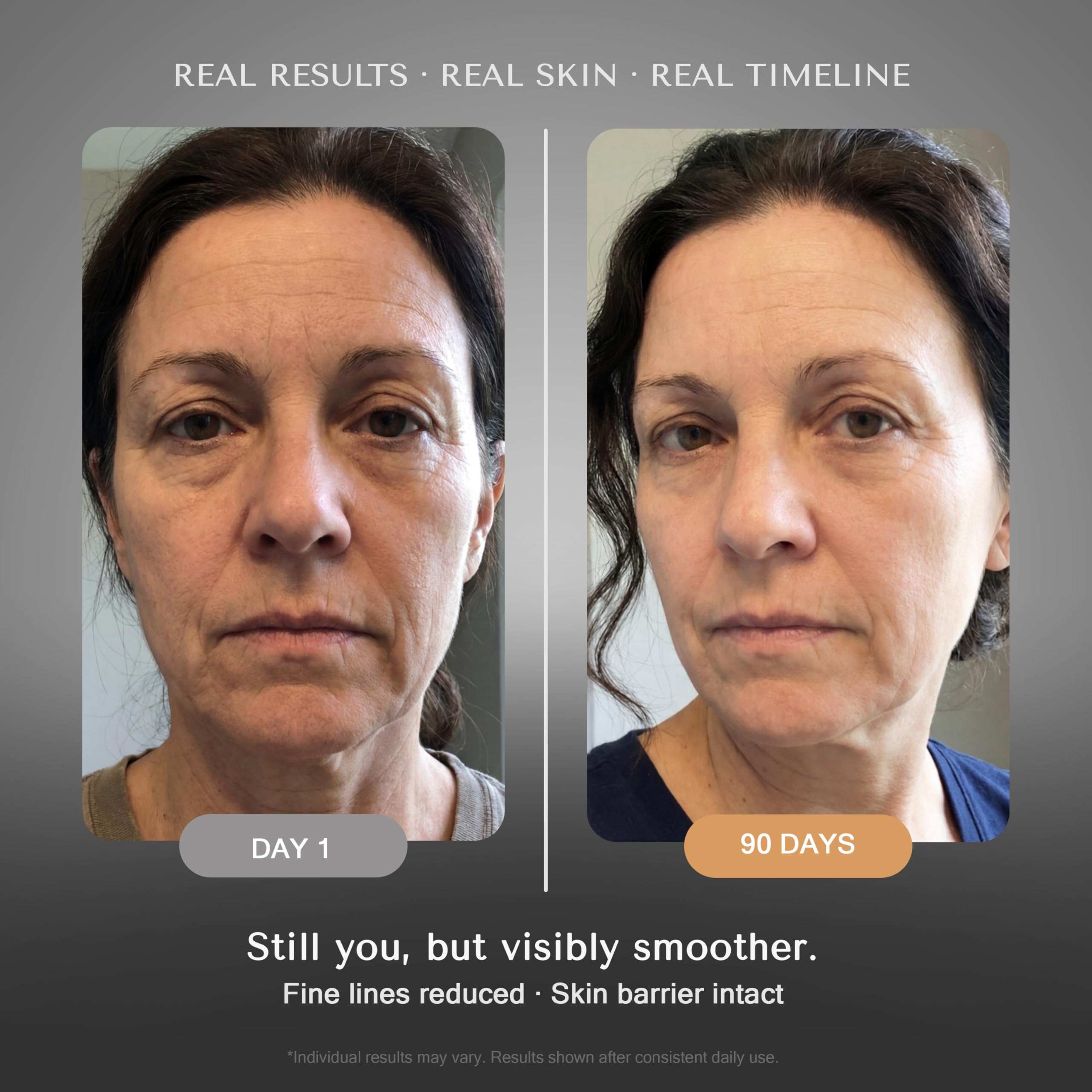 SOLURETINOL night serum dropper closeup highlighting controlled application