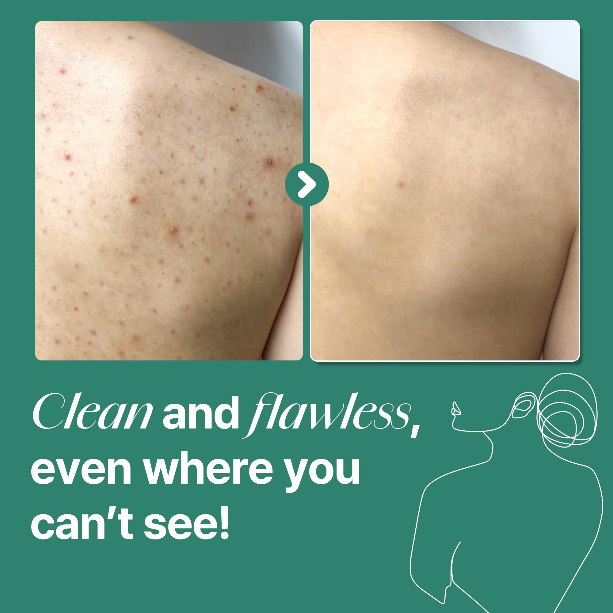 SOME BY MI texture on hand showing smooth gel foam and mild exfoliation
