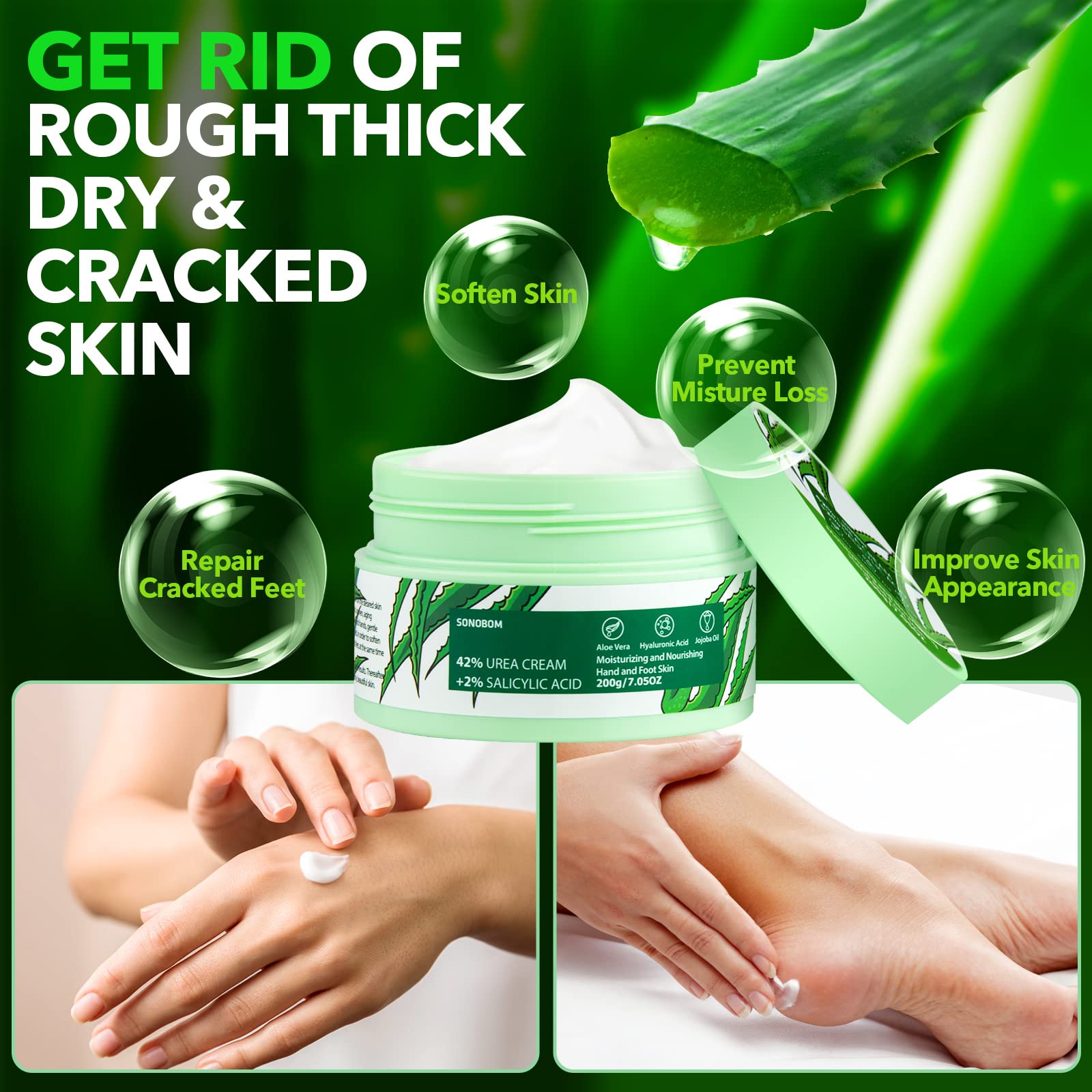 Sonobom urea cream application on heel demonstrating targeted moisturization