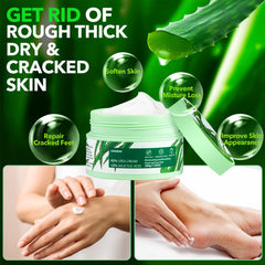 Sonobom urea cream application on heel demonstrating targeted moisturization