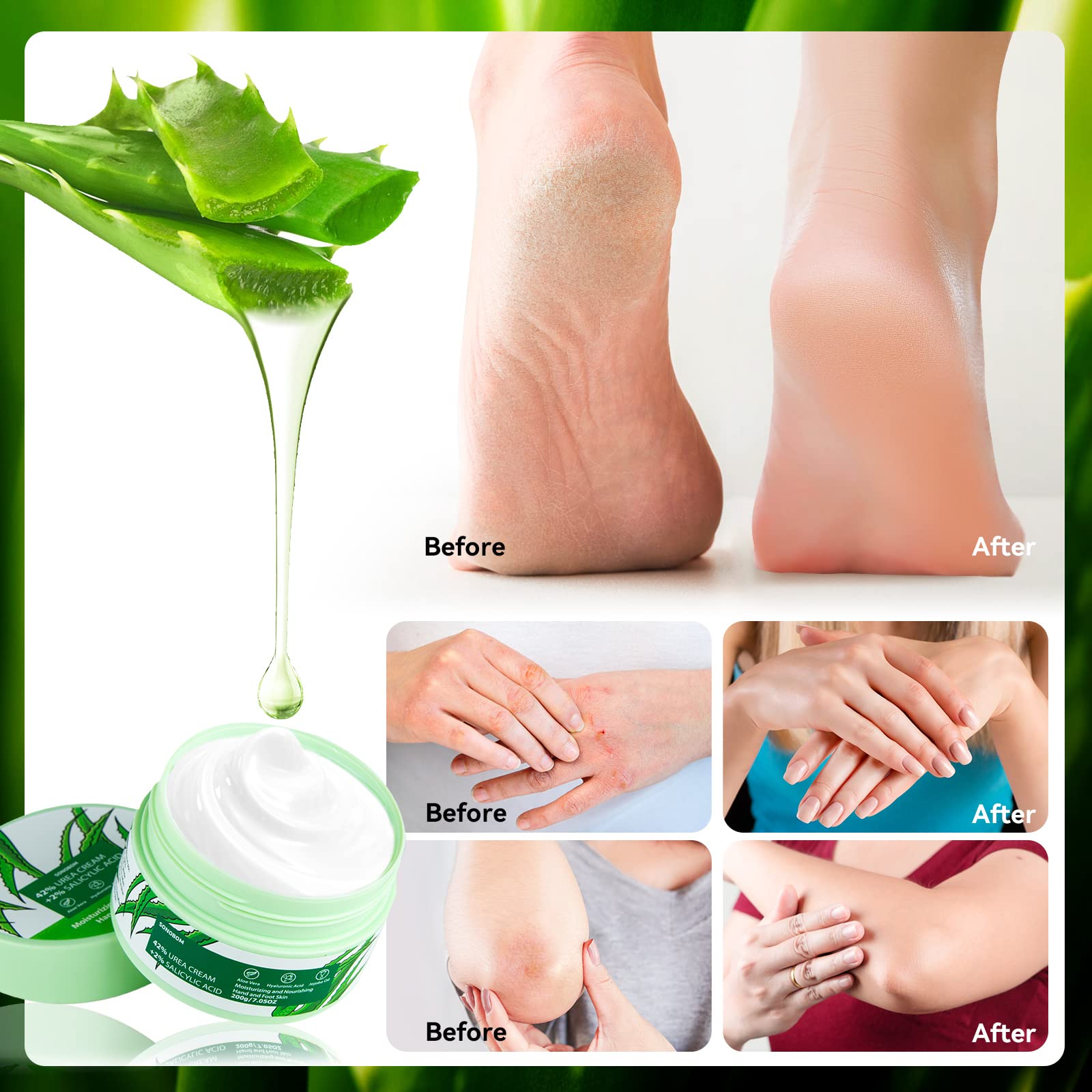 Sonobom urea cream held in hand to show 7.0 oz scale for lasting supply