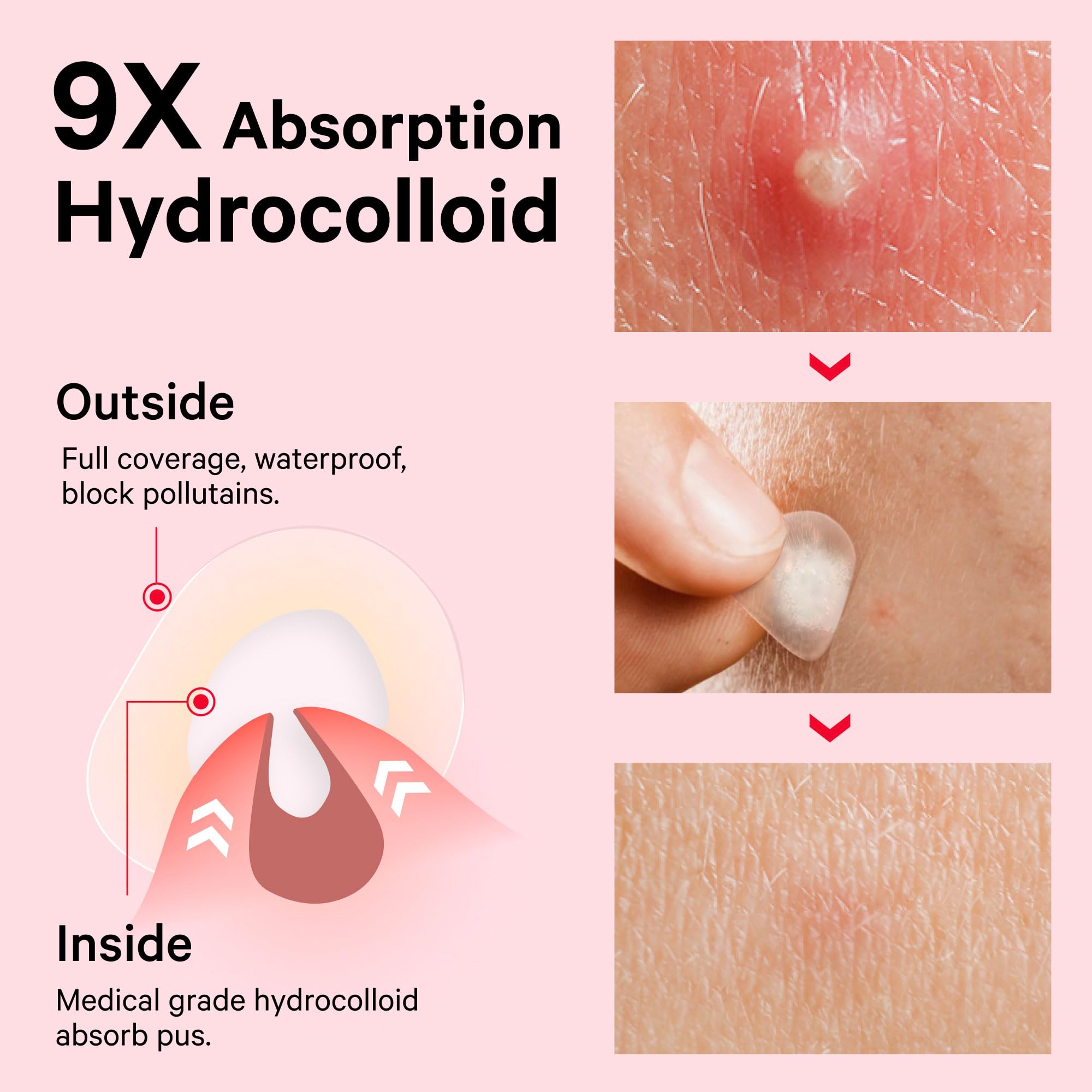 Sosky patch applied on cheek demonstrating secure adhesion