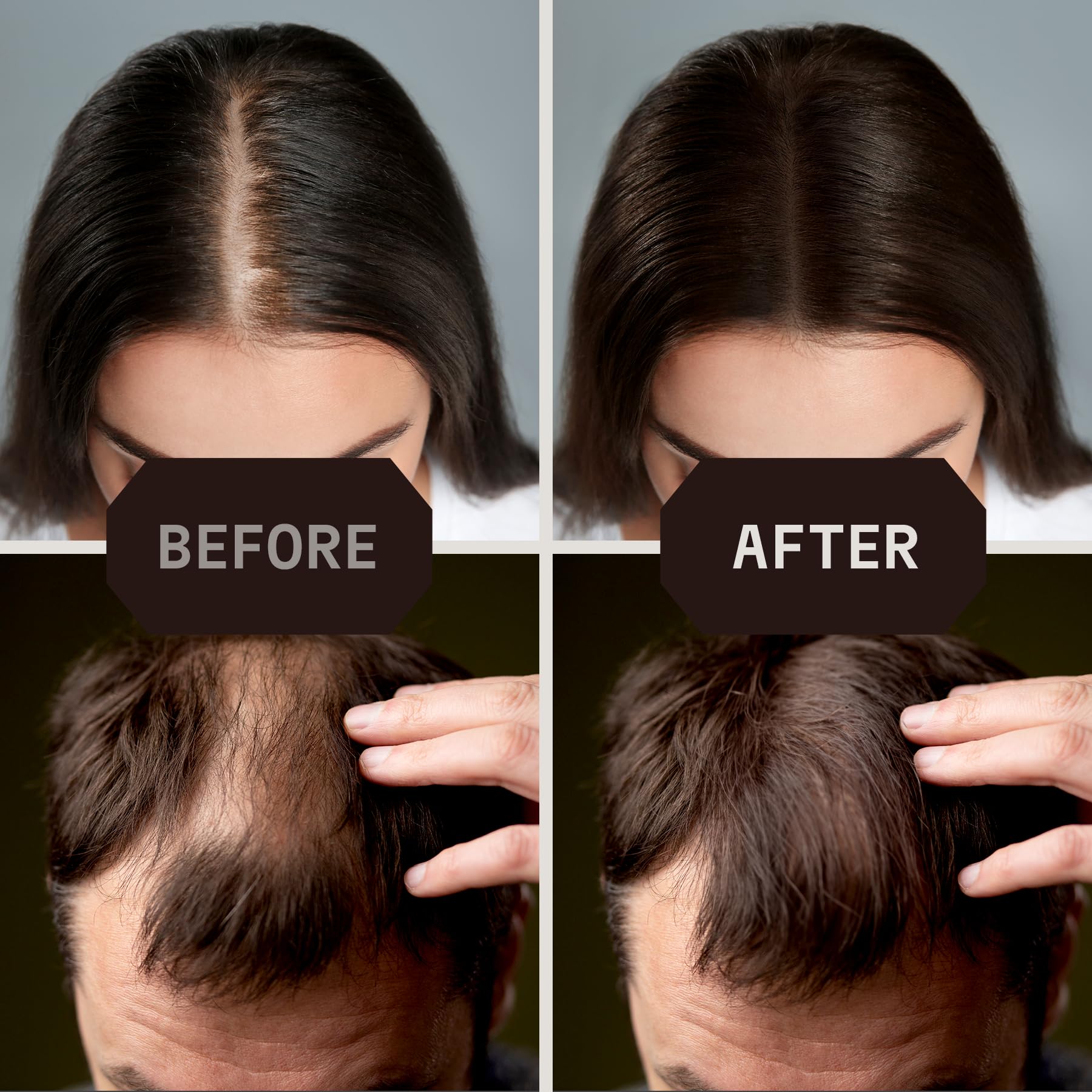 Top-view before and after using Striking Viking fibers demonstrating fuller hair benefit