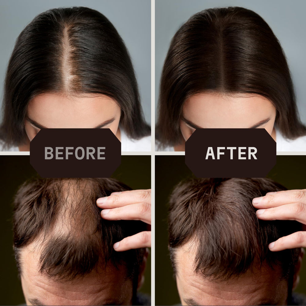 Top-view before and after using Striking Viking fibers demonstrating fuller hair benefit