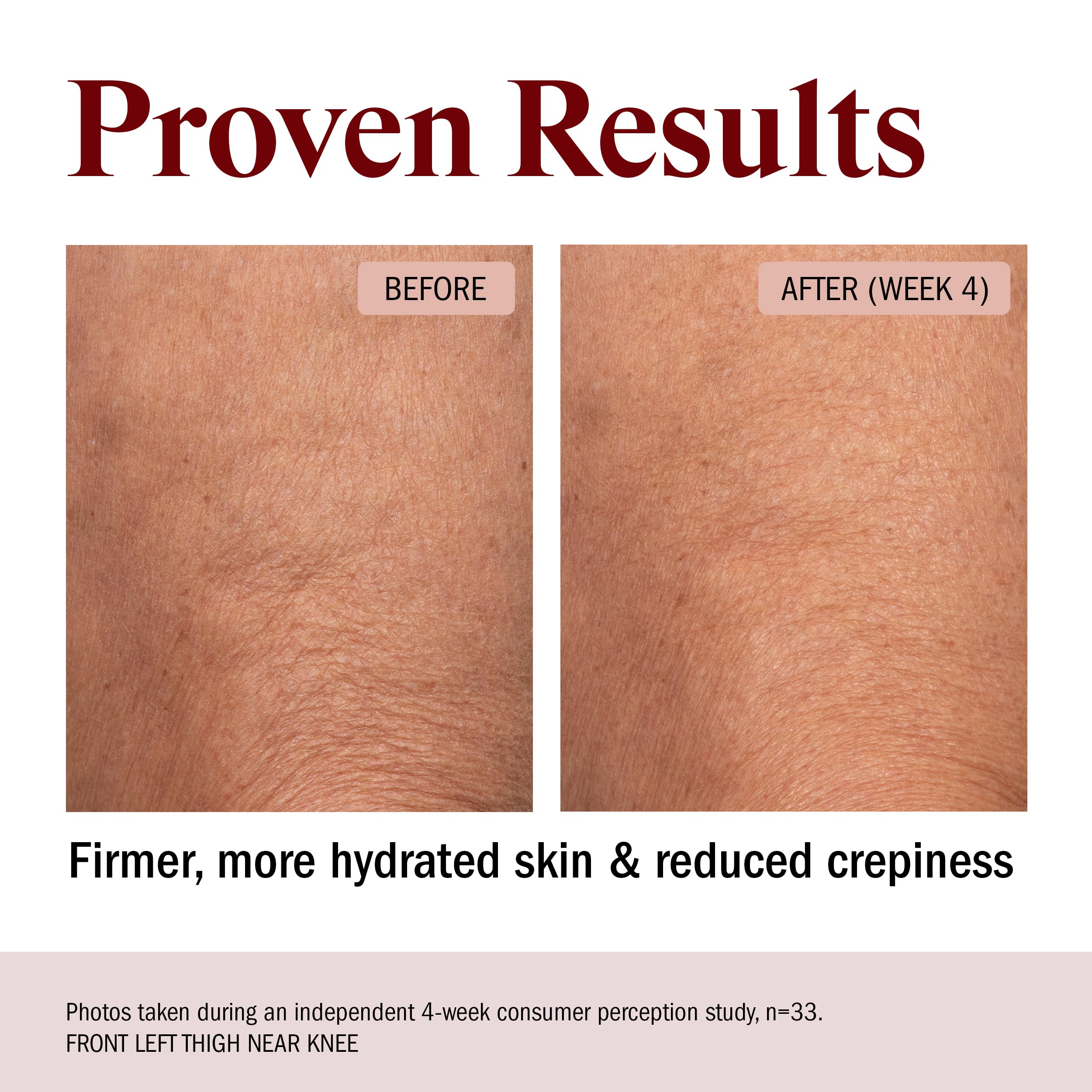 STRIPES applying body butter on arm demonstrating smooth spread and hydration