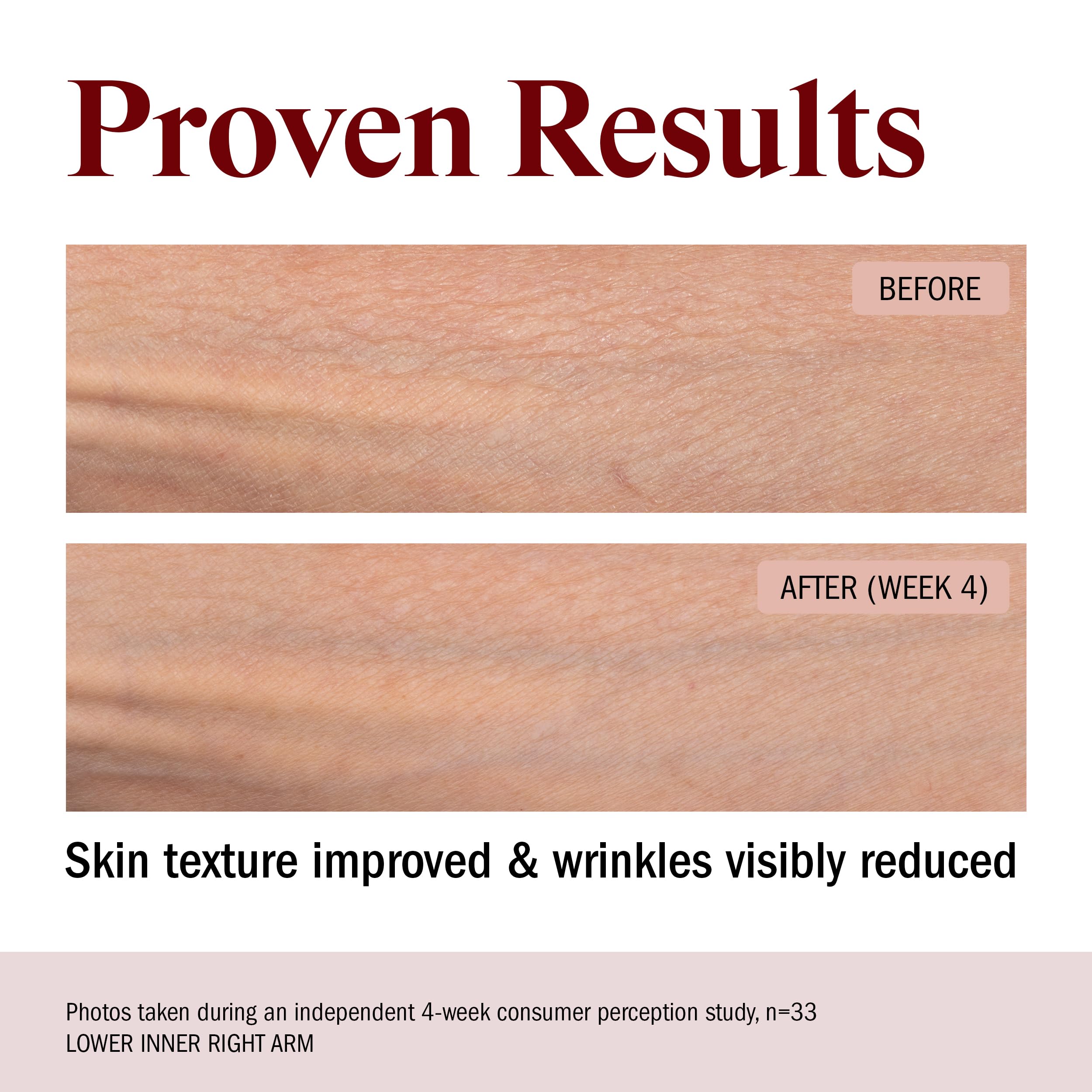 STRIPES ingredient display featuring ectoine to highlight moisture retention benefit