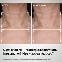 StriVectin applied to neck demonstrating easy absorption and smoothing