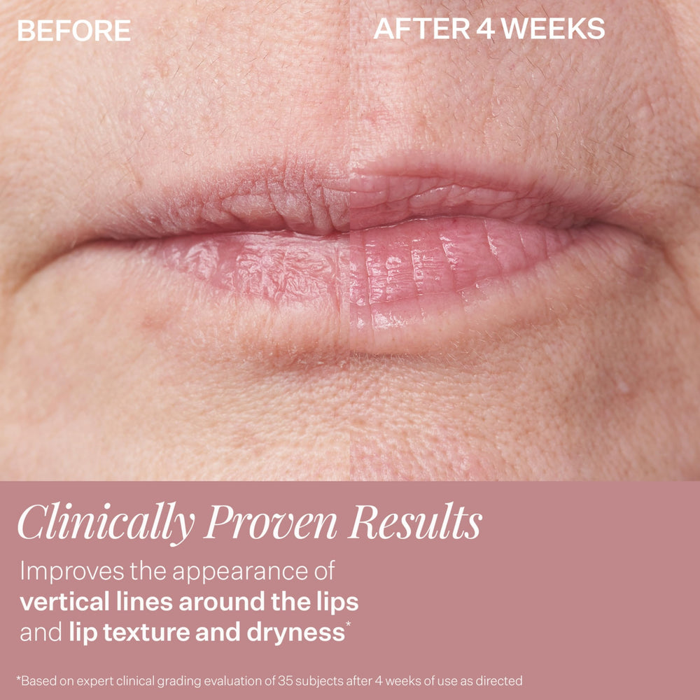 StriVectin DoubleFix lifestyle application on model illustrating hydrated, fuller lips
