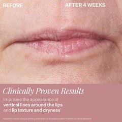 StriVectin DoubleFix lifestyle application on model illustrating hydrated, fuller lips