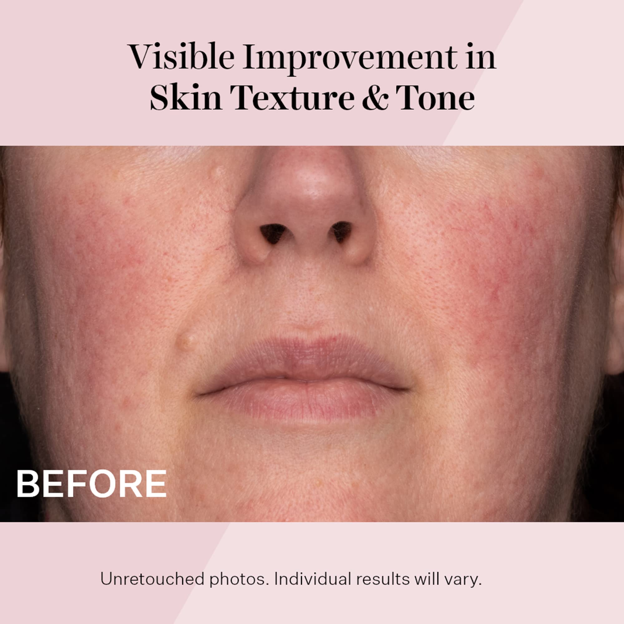 StriVectin ingredient panel with NIA-114 and peptides supporting barrier health