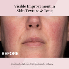 StriVectin ingredient panel with NIA-114 and peptides supporting barrier health