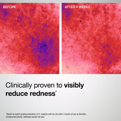 StriVectin cream applied to neck emphasizing firming and smoothing benefit