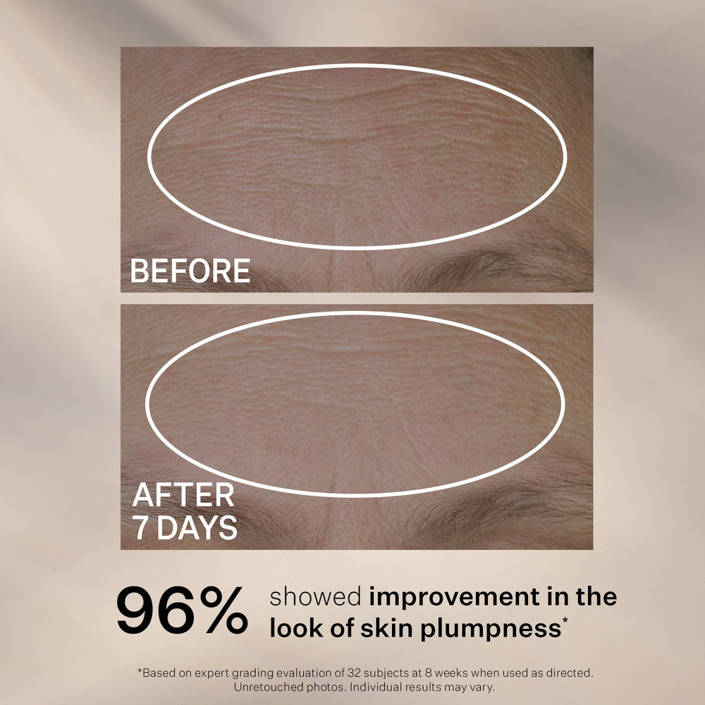 StriVectin applying serum to cheek demonstrating fast absorption benefit