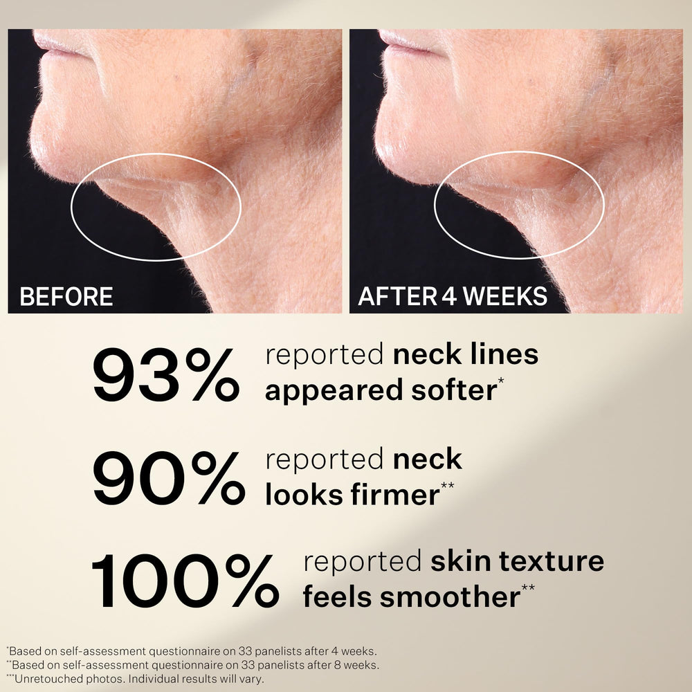 StriVectin label with NIA-114 highlighting strengthened skin barrier