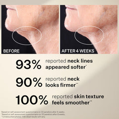 StriVectin label with NIA-114 highlighting strengthened skin barrier