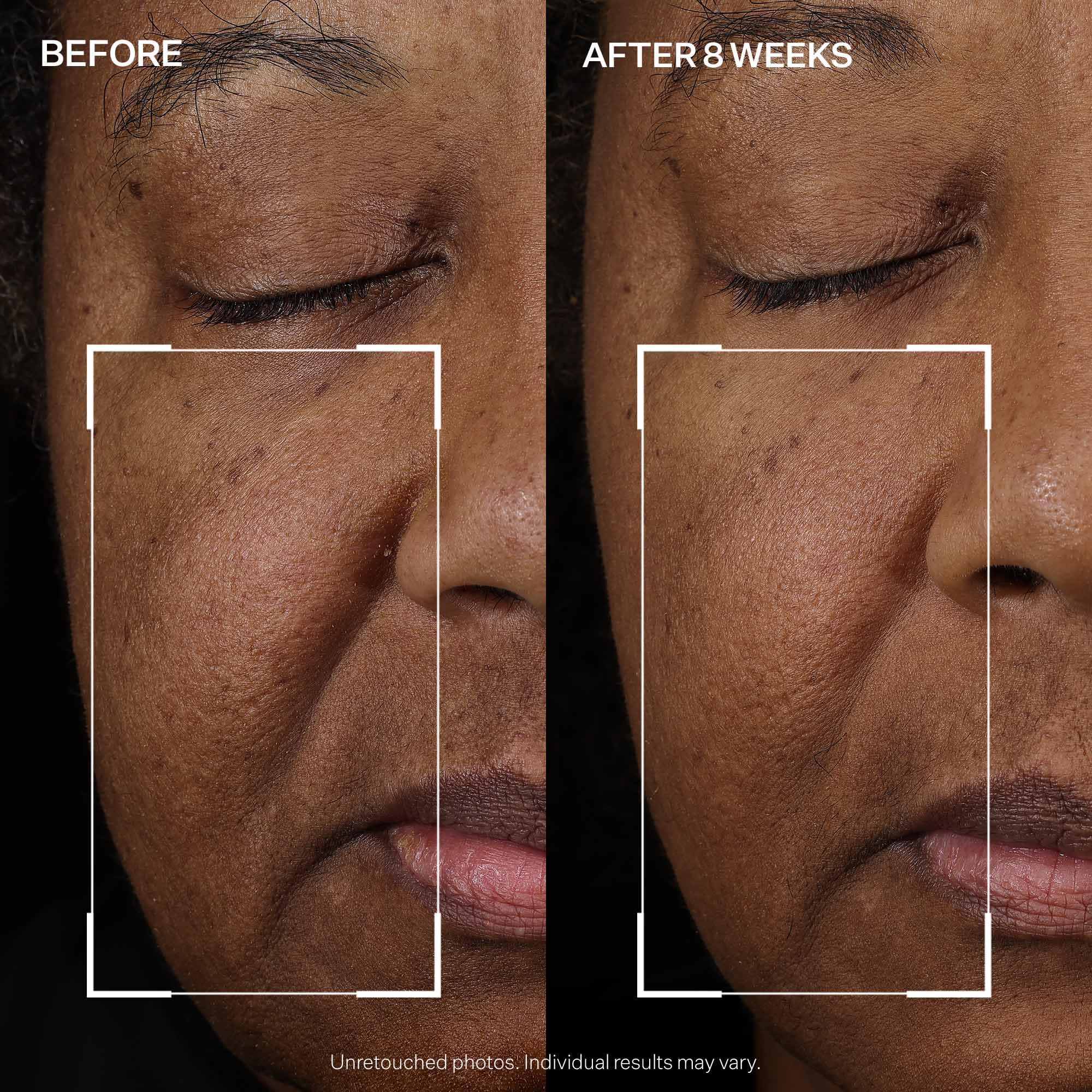 StriVectin label close-up emphasizing peptide blend and skin-friendly formulation