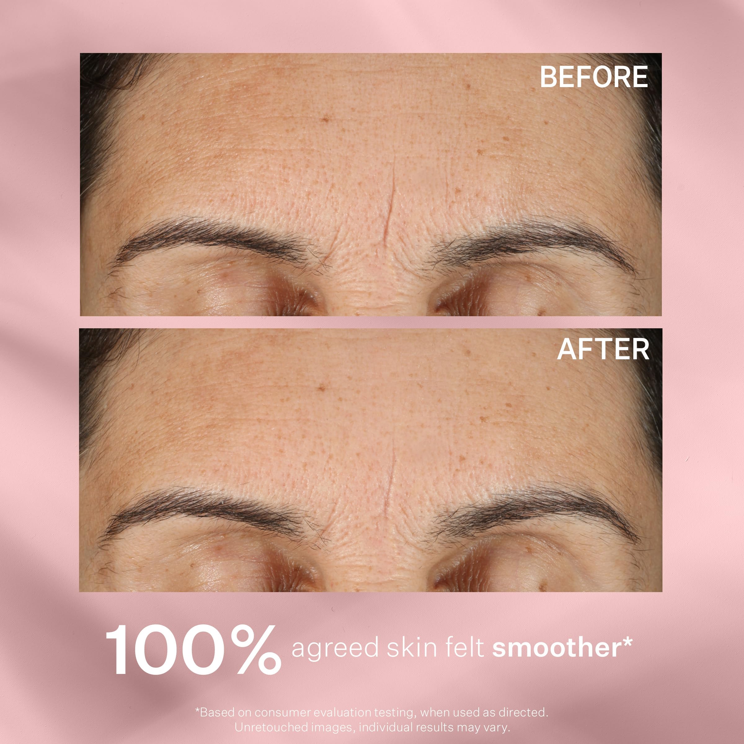 StriVectin next to ruler showing 1 oz size for travel-friendly benefit