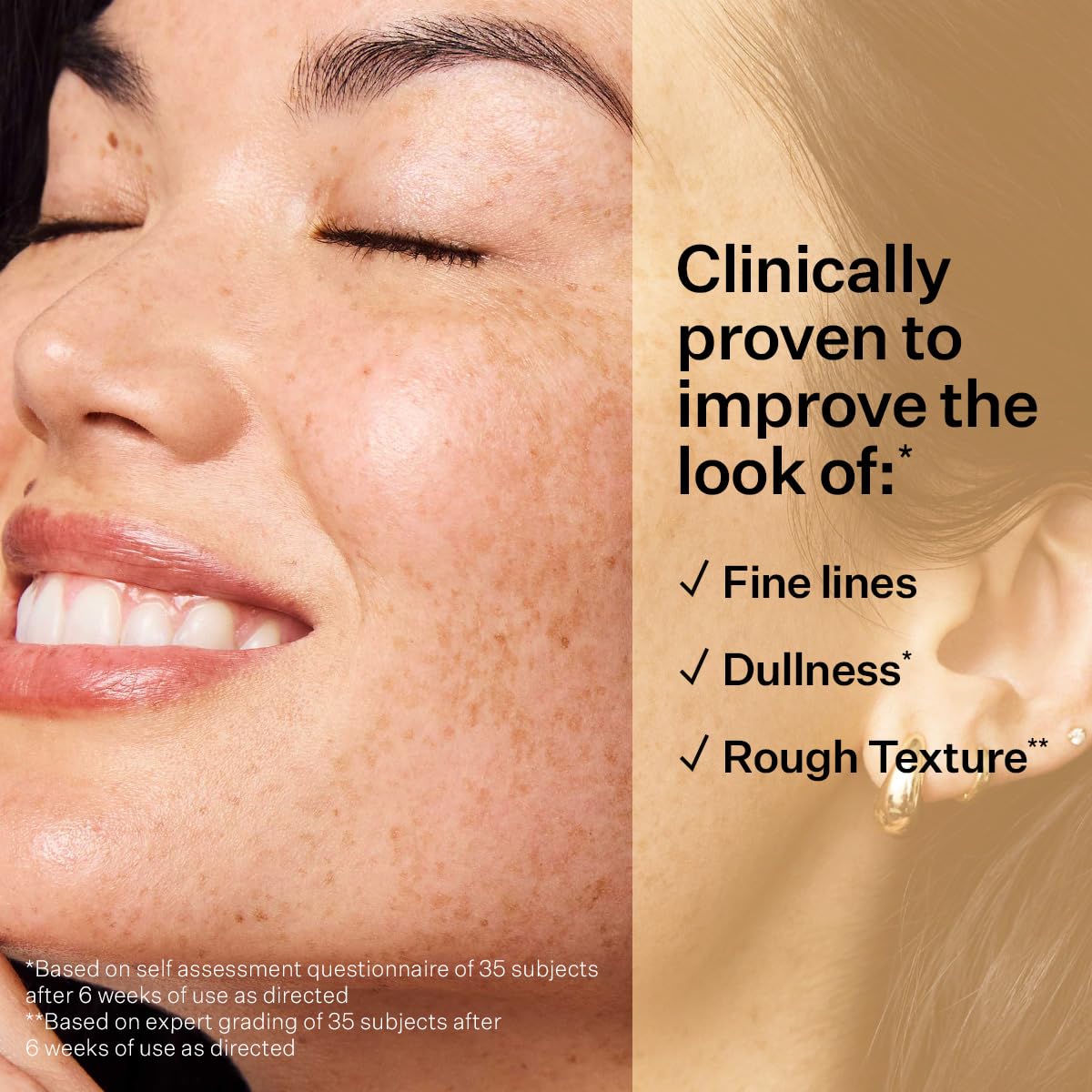 StriVectin applied to hands and neck demonstrating smoothing benefit