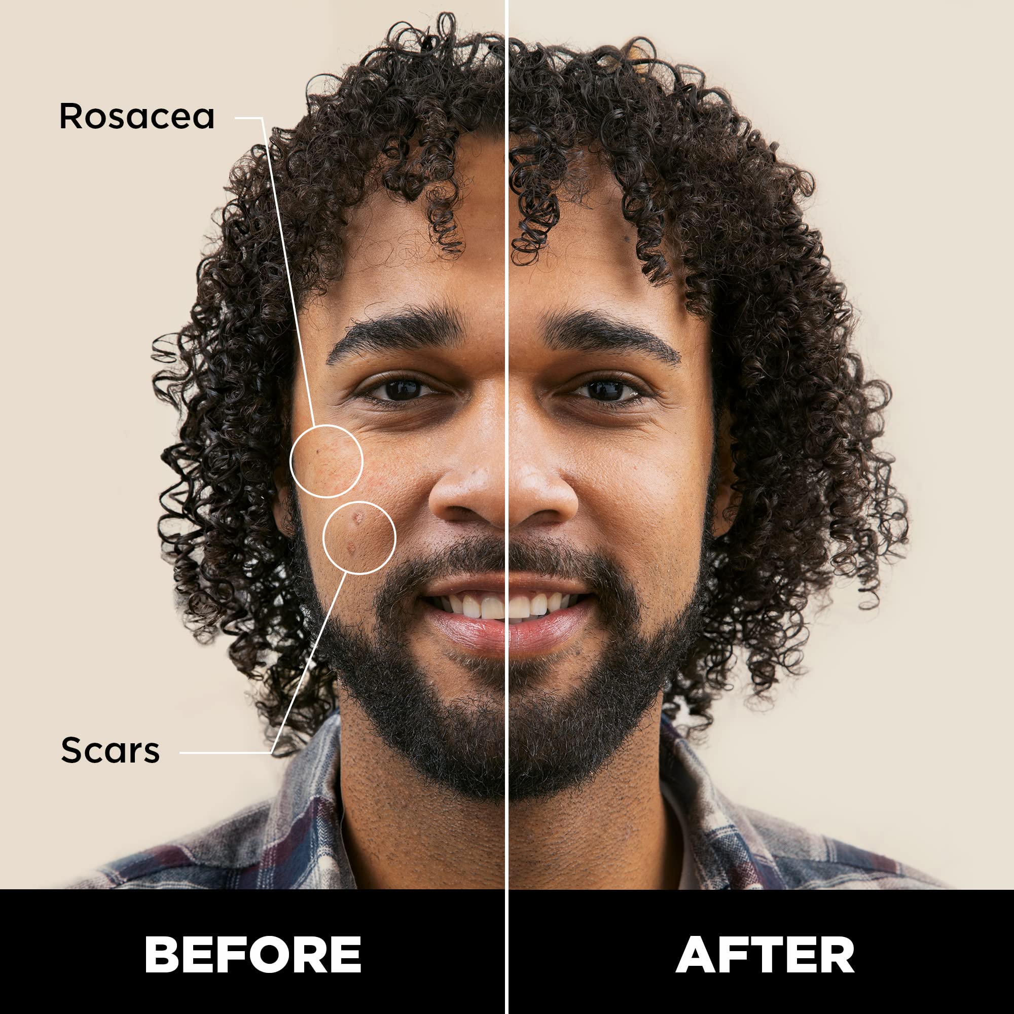Stryx concealer applied to cheek showing smooth blend and reduced redness benefit