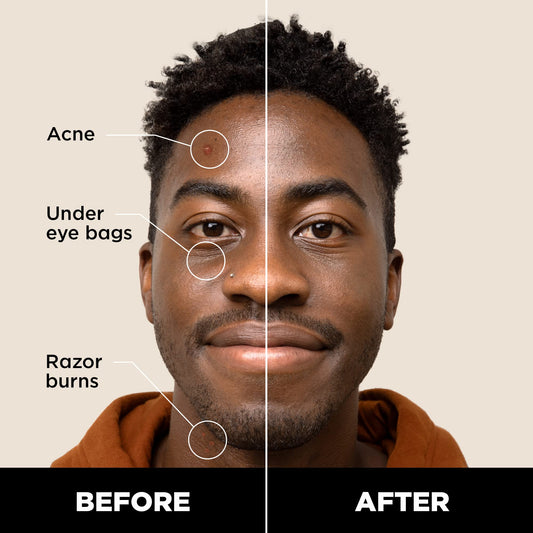 Stryx concealer tip close-up reveals twist mechanism for precise, no-waste application benefit