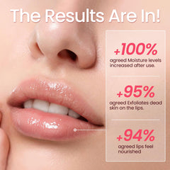 SUDAJI before and after lips comparison showing smoother fuller appearance