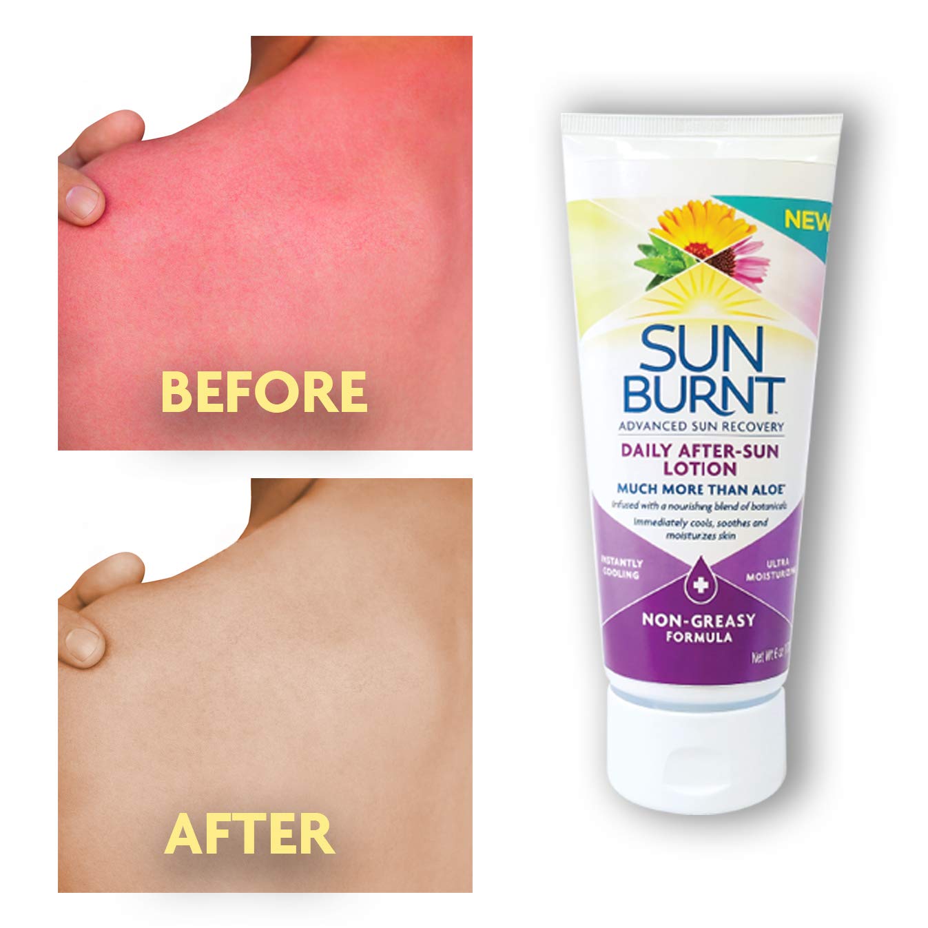 Sunburnt aloe and cucumber ingredients highlight botanical soothing benefit