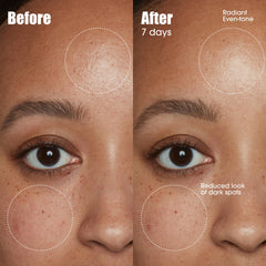 Sunday Riley serum dropper texture on skin demonstrating fast absorption benefit