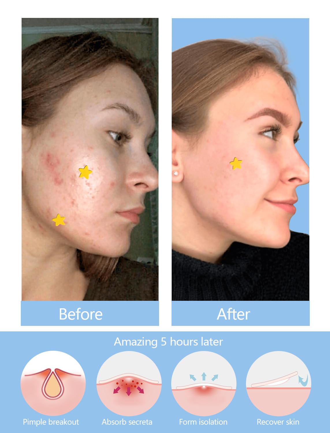 SVIPTP ingredient label with tea tree salicylic cica highlighting gentle support
