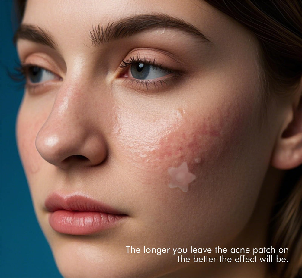 SVIPTP star patch applied on cheek providing discreet protection
