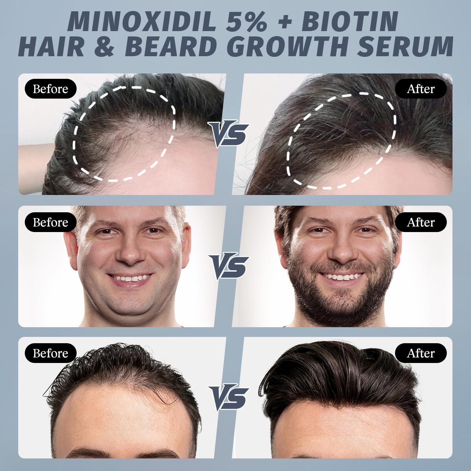 Sylvaseren with rosemary and biotin ingredients highlighting nourishment