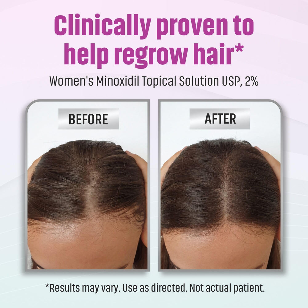 TARO label close-up highlighting 2% minoxidil strength and dermatologist ingredient