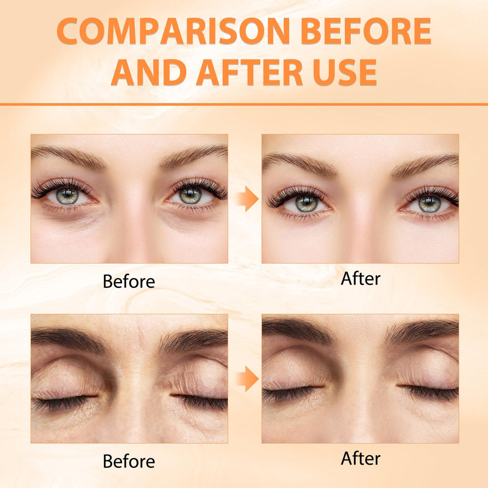 Tbexem closeup jar label highlighting ingredients and brightening claim