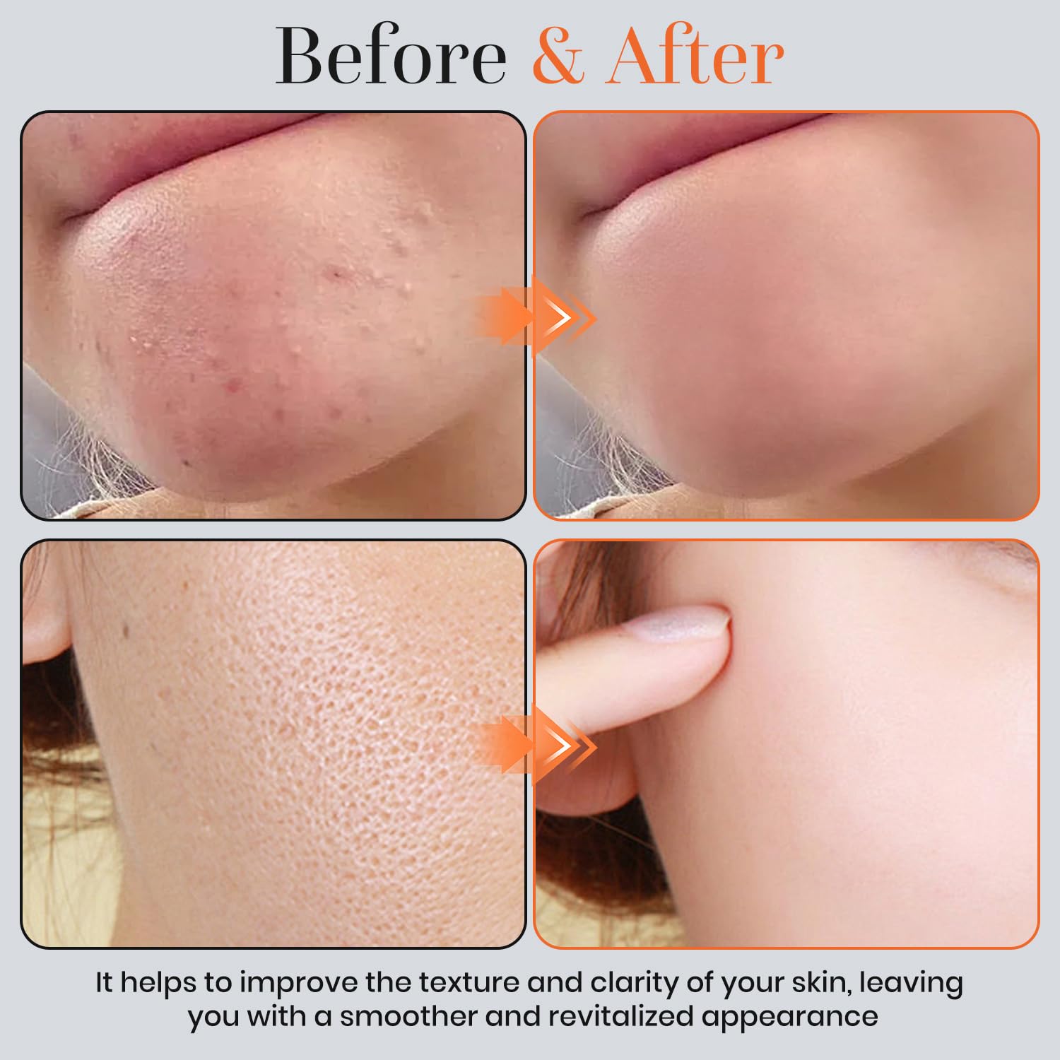 T.Chilyn application on face demonstration illustrating gentle exfoliation