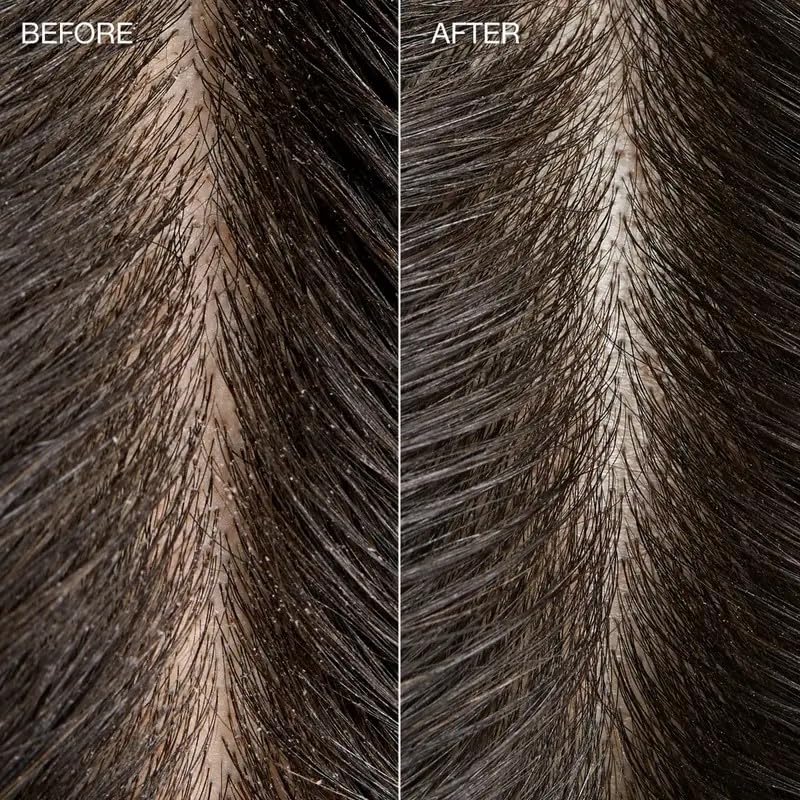 Tea Tree applying scrub on scalp to remove buildup and refresh