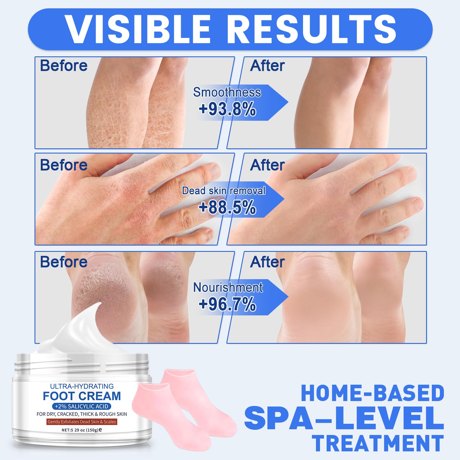 TEAWOO application on heel showing targeted treatment for cracked skin